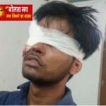 देवरिया में युवक पर पिलास से हमला, आंख और सिर पर गंभीर चोटें