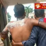 देवरिया में बिजली मरम्मत के दौरान बड़ा हादसा, संविदा लाइनमैन करंट से झुलसा