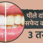 दांतों की सफाई के लिए घरेलू उपाय: बिना केमिकल के पाएं मोती जैसे सफेद दांत