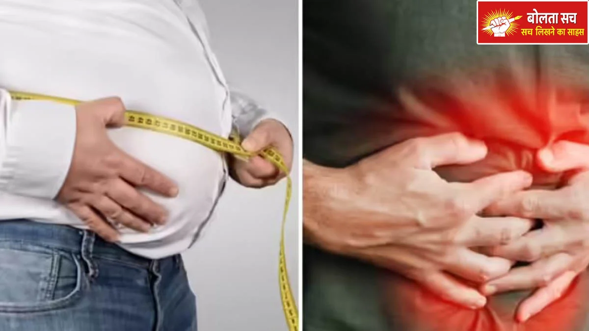 Obesity can increase the size of the stomach